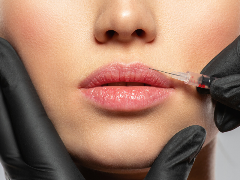 Botox na Medicina Dentária