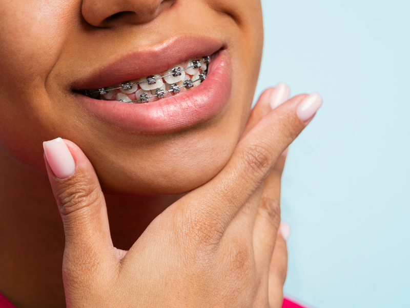 Ortodontia para adultos